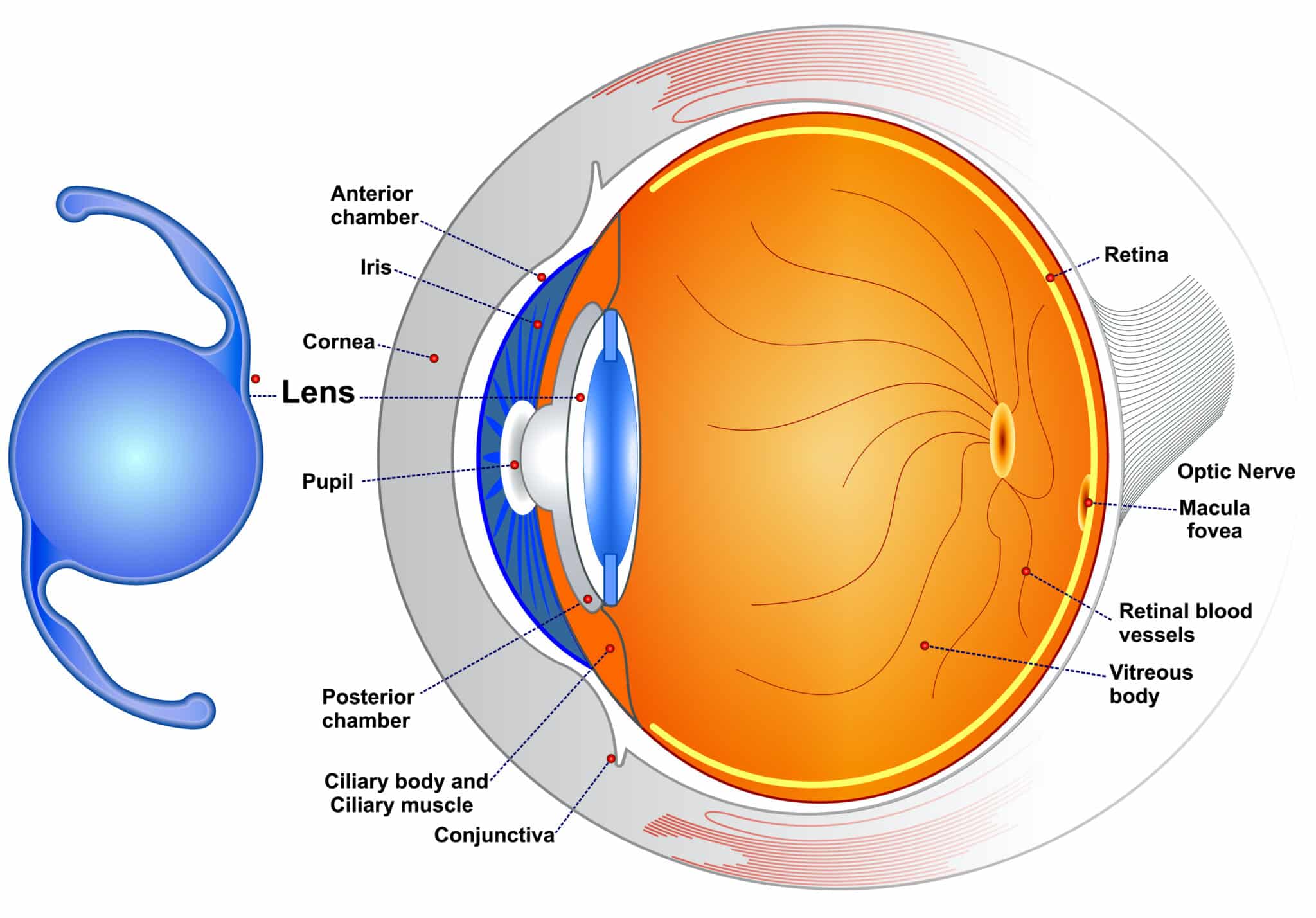 Refractive Lens Exchange Cincinnati | LASIK Alternatives Florence